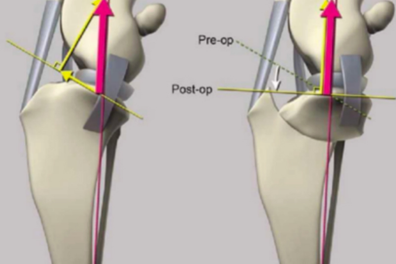 TPLO treatment of anterior cruciate ligament rupture in dogs and cats